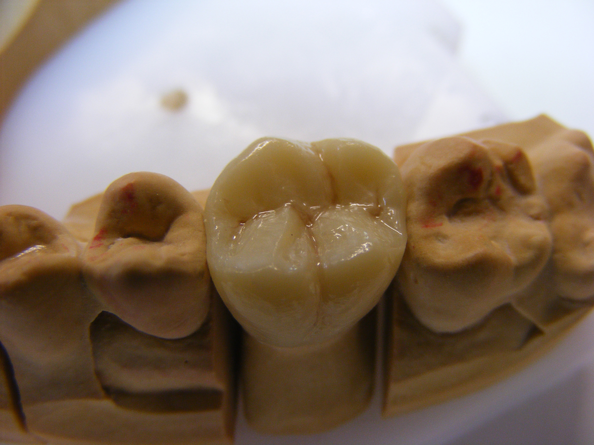 EMAX crown