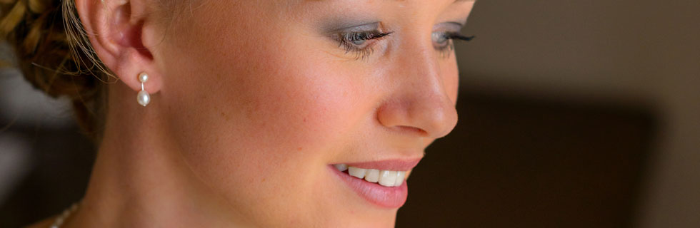 Smile makeovers